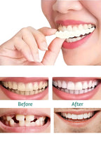 Fit Flex Cosmetic Denture Teeth for Instant Smile