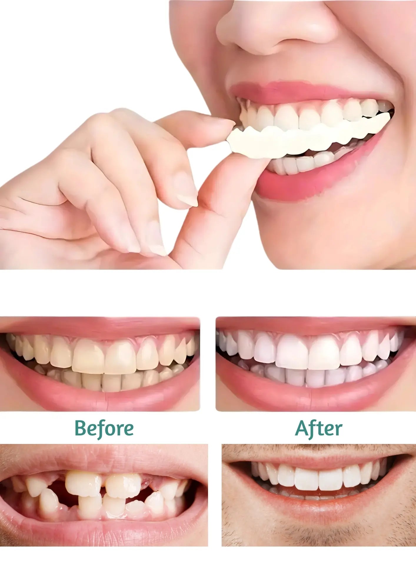 Fit Flex Cosmetic Denture Teeth for Instant Smile