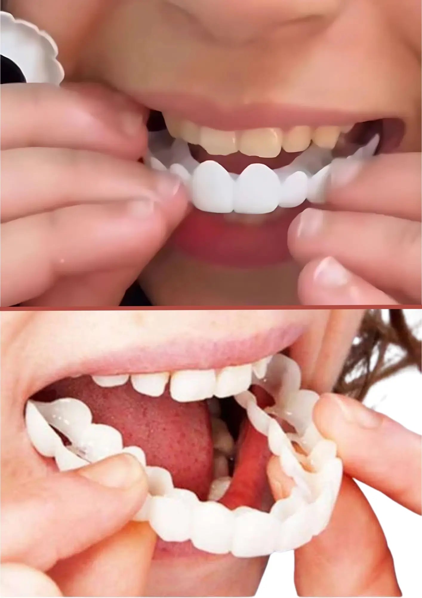 Fit Flex Cosmetic Denture Teeth for Instant Smile